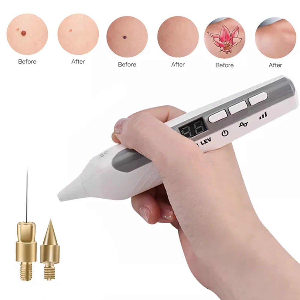 Aparelho Removedor de Sardas, Manchas e Verrugas com Tecnologia Plasma